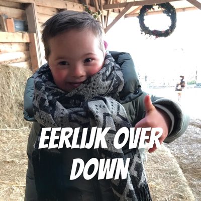 Cover van Eerlijk over Down